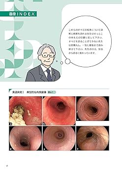 消化管超音波診断ビジュアルテキスト   /医学書院/春間賢（単行本） 病態を考える! はるま先生の見るから診るへの内視鏡診断学: 診療